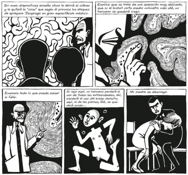 Operación de la epilépsia Operación de la epilépsia